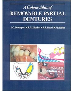 A Colour Atlas of Removable Partial Dentures