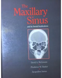 Maxillary Sinus and Its Dental Implications