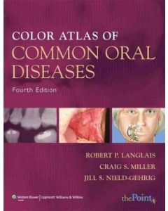 Common Oral Diseases