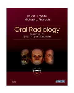 Oral Radiology Principles and Interpretation