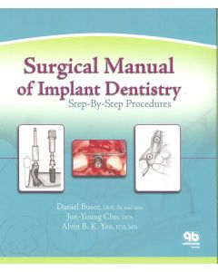 Surgical Manual of Implant Dentistry: Step-by-step Procedures