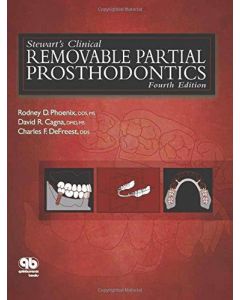 Stewart's Clinical Removable Partial Prosthodontics 4th Edition