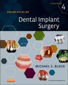 Color Atlas Of Dental Implant Surgery