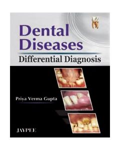 Dental Diseases Differential Diagnosis