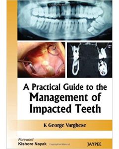 A Practical Guide to the Management of Impacted Teeth