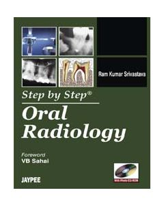 Step By Step Oral Radiology