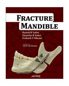 Fracture Mandible