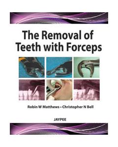 The Removal Of Teeth With Forceps